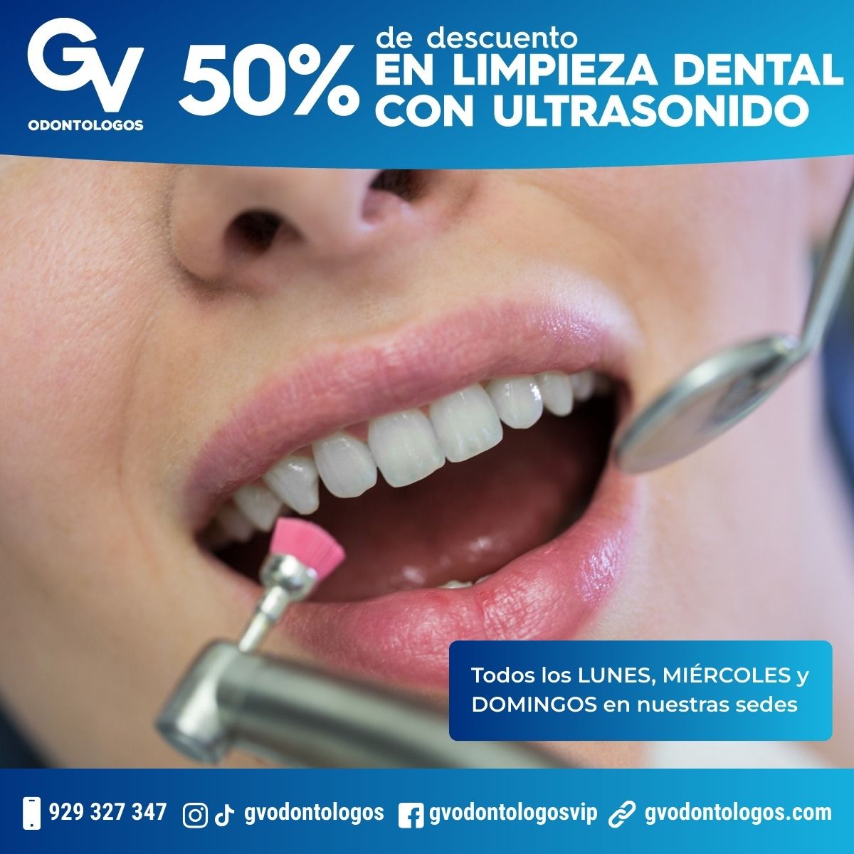 Limpieza Dental - - Lima - Perú - Jesús María - Pueblo Libre - Magdalena del Mar