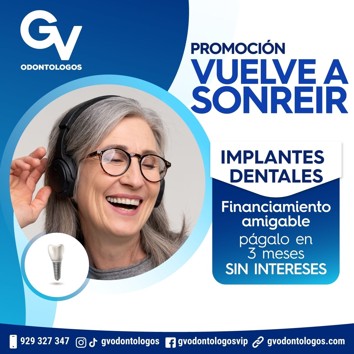 Implantes Dentales - - Lima - Perú - Jesús María - Pueblo Libre - Magdalena del Mar